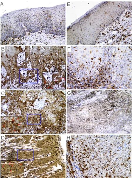 Figure 1: Expression of p22phox was significantly higher in CDDP-resistant than CDDP-sensitive OSCC tissues