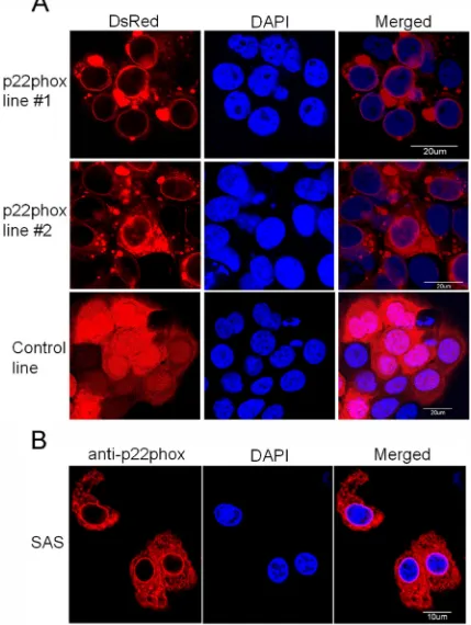 Figure 6: Overexpression of p22phox led to its perinuclear localization in OSCC cells