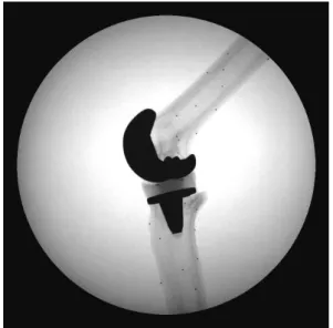 Figure 1.2: Typical high quality fluoroscopic frame of a phantom experiment