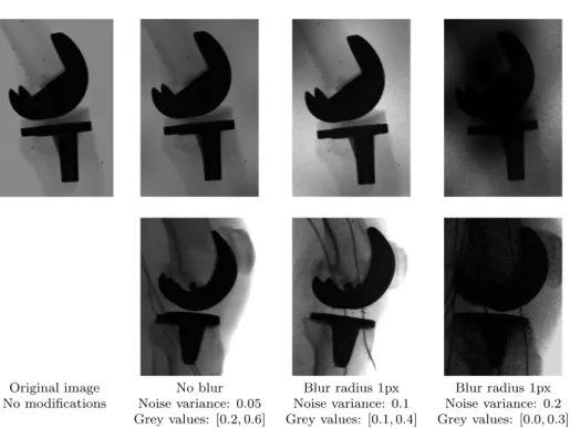Figure 2.2: Examples of reduced quality images of the phantom experiment in the first row and their clinical counterparts on the second row