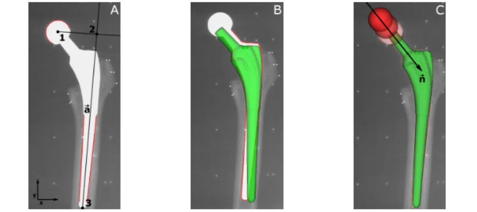 Figure 3.1: EGS-RSA: The first landmark (1) is formed by the estimation of the center of the spherical head