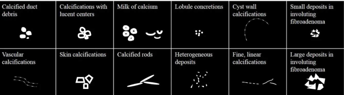 Figure 1.5 Illustration of many calcification types that are observed with mammography