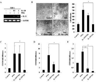 Figure 4: Ectopic expression of IL-32θ inhibits differentiation of THP-1 cells. (A) THP-1 cells were transfected with empty pcDNA3.1+ vector or the indicated amount of pcDNA3.1+-IL-32θ-6 × Myc and incubated overnight