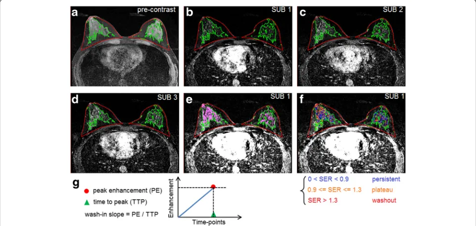 Fig. 1 Automated measurement of contrast enhancement kinetic variables from normal parenchyma