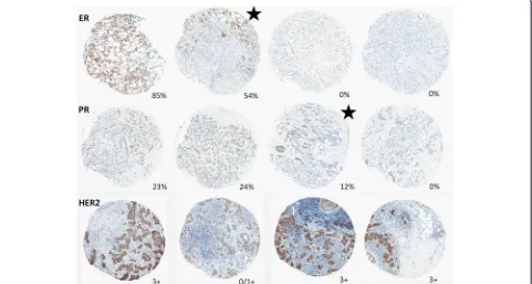 Fig. 2 Representative images of cases with manually confirmed heterogeneous expression of ER, PR, and HER2 between any two cores from theheterogeneity.same case