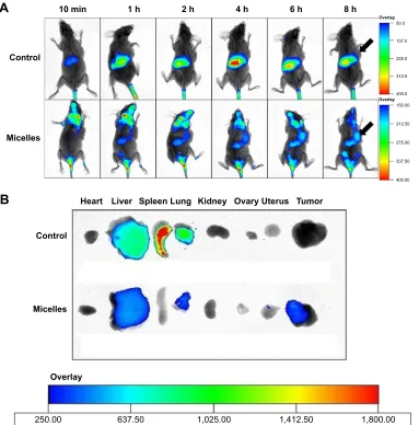 Figure 5 The time-dependent in vivo fluorescence images of DiR solution and DiR-loaded micelles in A549 tumor-bearing female nude mice after tail vein injection (A)