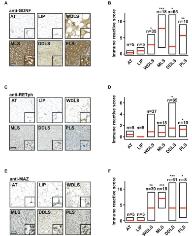 Figure 6: Levels of GDNF, phosphorylated RET, and MAZ are increased in liposarcoma samples of patients