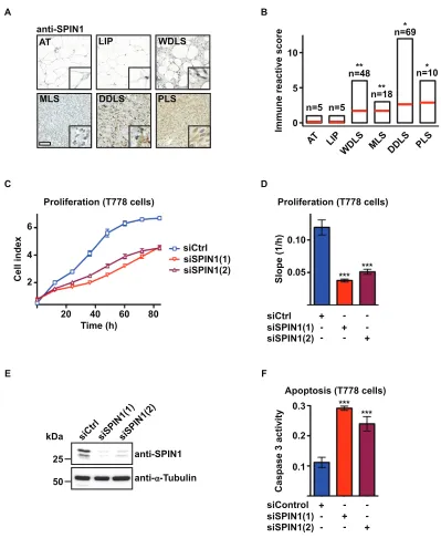 Figure 1: SPIN1 knockdown decreases proliferation and increases apoptosis of liposarcoma cells