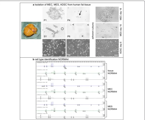 Fig. 1 Isolation of mammary epithelial cells (MEC), mesenchymal cells (MES) and adipose-derived stem cells (ADSC) from human fat tissue and celltype identification of normal mammary cells (NORMA)4