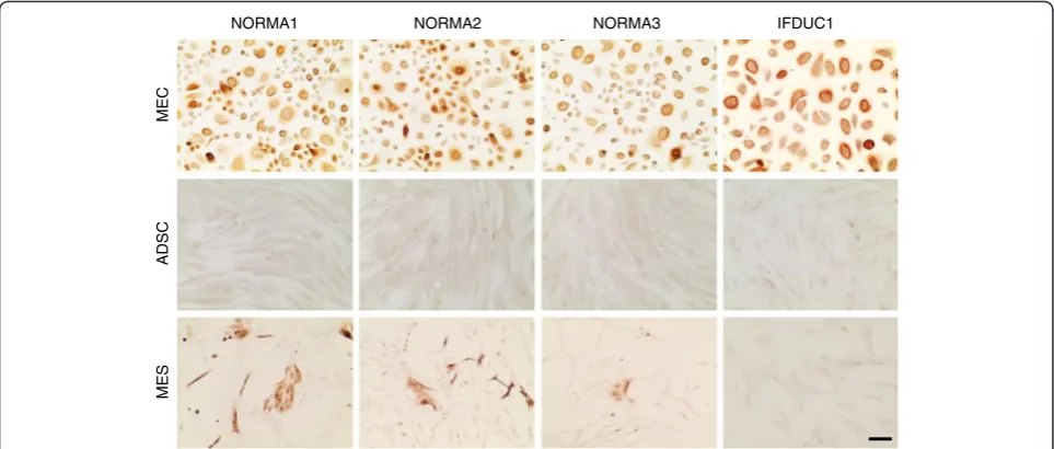 Fig. 3 Epithelial membrane antigen (EMA)/MUC1 immunocytochemical staining of cell isolates