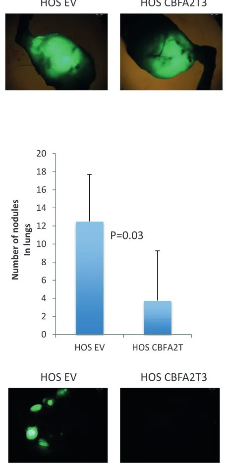 Figure 10: Effect of CBFA2T3 overexpression in HOS cells on primary tumors and lung metastases