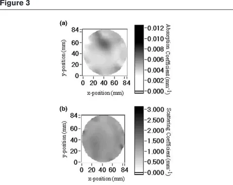Fig. 4 depicts the light image and the contrast-enhancedfluorescence image of a LX-1 tumor implanted into themammary fat pad of a nude mouse