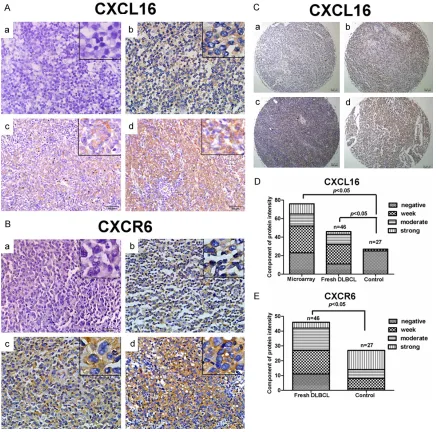 Figure 1. Characterization of CXCR6 and CXCL16 expression in DLBCL. The expression of CXCL16 and CXCR6 in 46 fresh DLBCL tissues, 76 microarray tissues as well as 27 control reactive lymphoid hyperplasia tissues was characterized by immunohistochemistry an