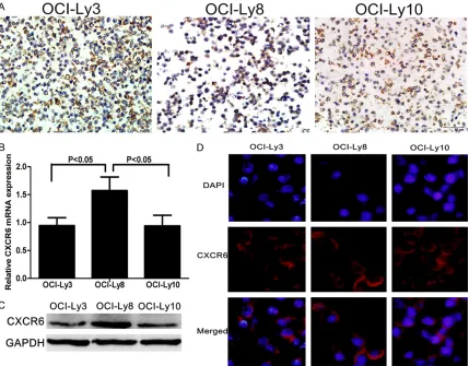 Figure 3. Characterization of CXCR6 expression in DLBCL cells. The relative levels of CXCR6 to control GAPDH ex-pression in OCI-Ly3, OCI-Ly8, and OCI-Ly10 cells were determined by immunohistochemistry, qRT-PCR, Western blot and immunofluorescent assays