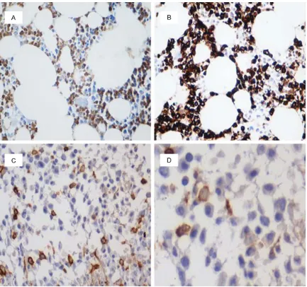 Figure 2. A. Granulocytes showing expression of CD15. B. Granulocytes were strongly positive by anti-MPO stain