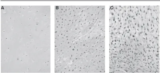 Figure 1.1: Histology chondrosarcoma grade I (A), II (B), and III (C)