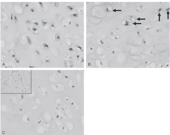 Figure 3.2: Light micrograph showing the immunohistochemical nuclear and cytoplasmic localization of INK4A/