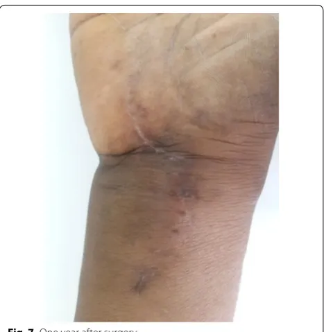 Fig. 7 One year after surgery