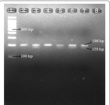 Fig. 1 RFLP analysis after digestion with HinfI showing homozygous C/C, heterozygous C/T genotype variants
