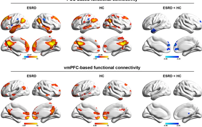 Fig 1. Within-group DMN patterns and between-group differences. The color bars represent the T scores