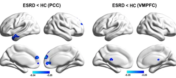 Fig 3. Between-group functional connectivity differences after excluding two patients with anemia.