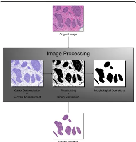 Figure 1 Overview of the tumour extraction algorithm.