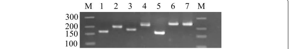 Figure 1 Agarose gel (3%) electrophoresis showing amplicon size for seven candidate reference genes