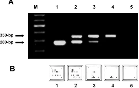 FIG. 2. RT-PCR ampliﬁcation with the CCHF virus-speciﬁc assay(280-bp amplicon) and the internal control (350-bp amplicon).