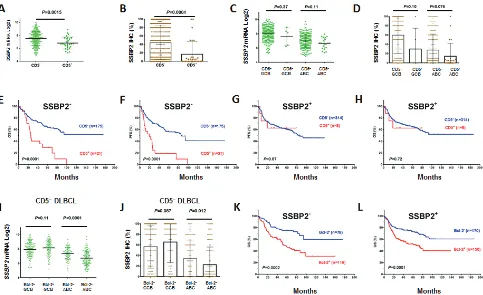 Figure 4: correlation between cd5 and ssbP2 expression in dlbcl. (A-D) CD5 expression was correlated with decreased not prognostic in patients with SSBP2 expression; (I-J) Bcl-2levels only in the ABC-DLBCL subset but not in the GCB-DLBCL subset; (K-L) The prognostic significance of Bcl-2SSBP2 expression; (E-F) The prognostic significance of CD5+ was present only in patients without  SSBP2 expression; (G-H) CD5+ was + compared with Bcl-2– patients had decreased SSBP2 mRNA and protein + was independent of SSBP2 expression.