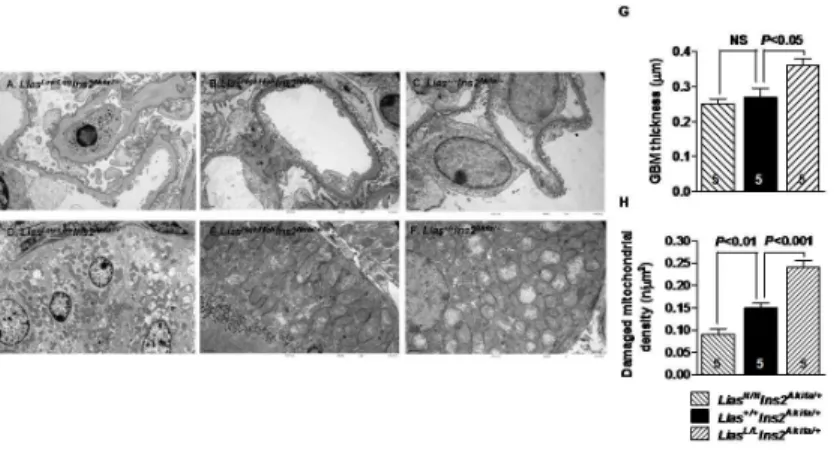 Fig 4. Representative electron micrographs from diabetic Ins2 Akita//+ mice at 28 weeks of age