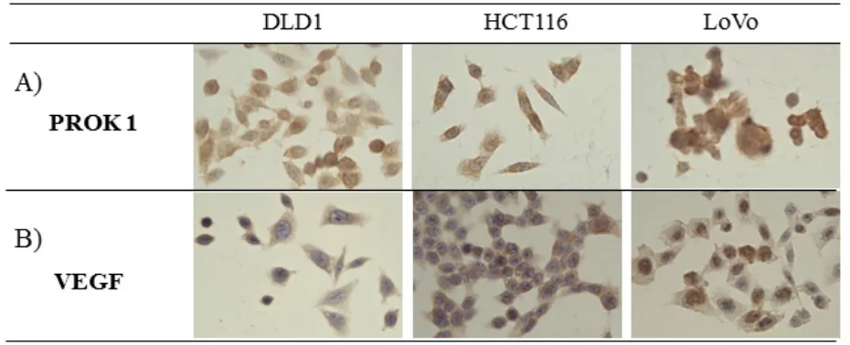 Figure 1: The expression of PROK1 and VEGF protein in colon cancer cell lines(DLD-1, HCT116, LoVo) by immunohistochemical staining with anti-PROK1 mAb