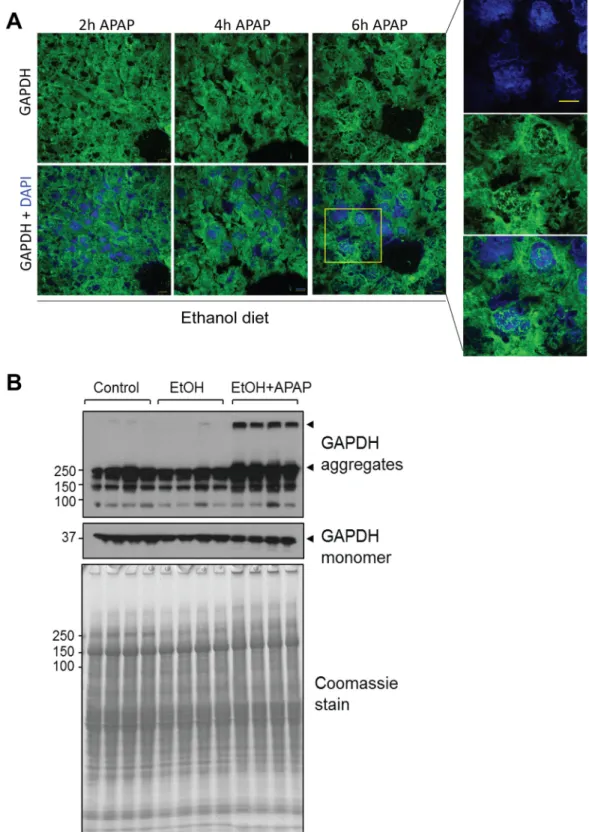 Fig 2. APAP promotes aggregation of cytoplasmic GAPDH in ethanol pre-treated mice. A. Indirect immunofluorescence analysis of GAPDH (green) together with DAPI-stained nuclei (blue) in livers from ethanol pre-treated mice that were given APAP for the indica