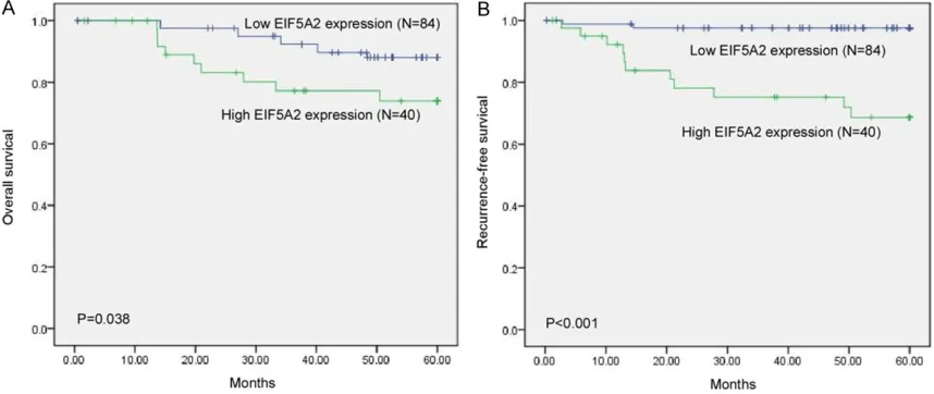 Figure 2. Expression of EIF5A2 protein in tissue by immunohistochemistry. A. Positive expression of EIF5A2 in cervi-cal cancer tissues