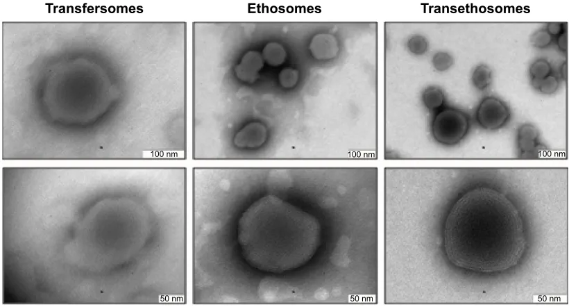 Figure 4 Microscopic appearance of ultradeformable vesicle formulations obtained by transmission electron microscopy.