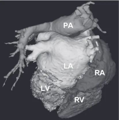 Figure 12. Segmentation of the MSCT scan into the diff erent structures using the CartoMerge TM  Image Integration Module