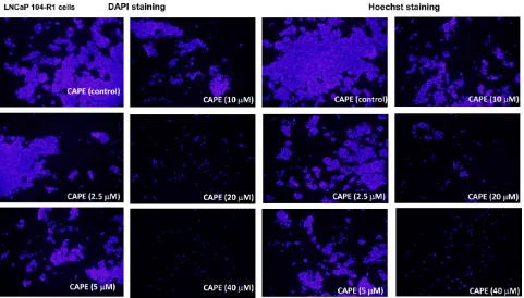 Figure 1: CAPE treatment for 96 h reduced cell proliferation of LNCaP 104-R1 cells. DAPI staining and Hoechst dye-staining of LNCaP 104-R1 cells being treated with increasing concentrations of CAPE for 96 h was used to monitor cell proliferation of LNCaP 104-R1 cells using fluorescent microscope with magnification of 100X.