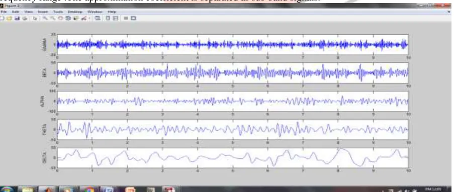 Figure 3:- shows the original signal ,after removal of noise ,baseline wander ,after removal of base line wander and clean EEG  signal