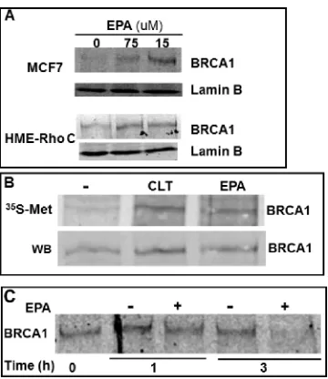 Figure 2: EPA translationally up-regulates BRCA1 in human breast cancer cells. (A) MCF-7 and HME-Rho C cells were treated with indicated concentrations of EPA for 20 hours, cell lysates were separated by SDS-PAGE and immunoblotted with BRCA1 specific antib