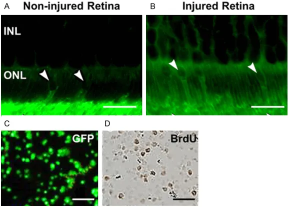 Figure 1. Donor rod cells migrate into ONL of recipients and survive post-transplantation