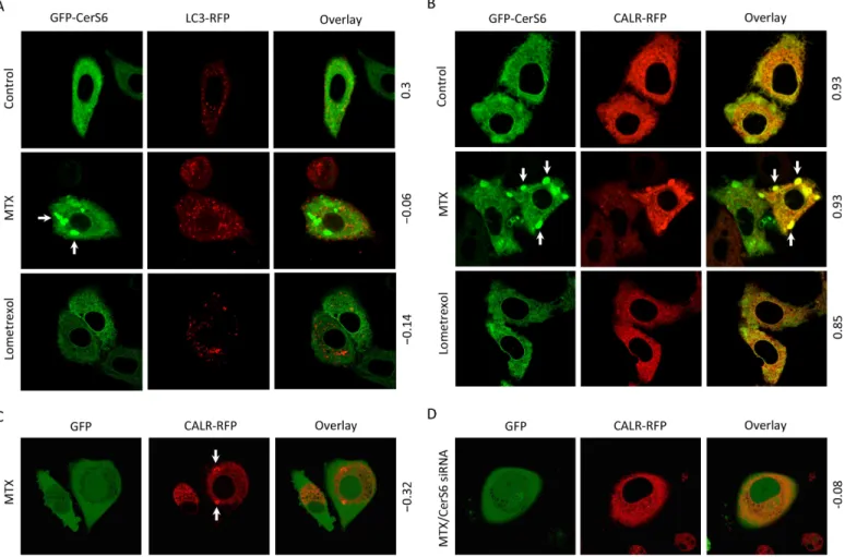 Fig 6. Methotrexate induces CerS6-dependent formation of ER membrane aggregates in A549 non-small cell lung carcinoma cells