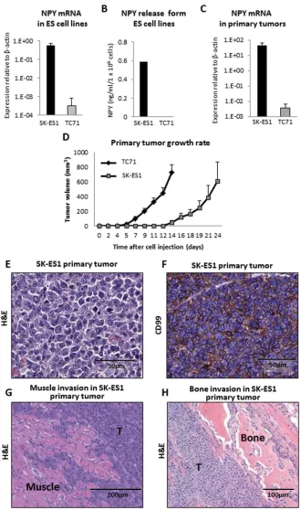 Figure 1: TC71 and SK-ES1 ES cells varying in NPY expression and release give rise to invasive primary tumors