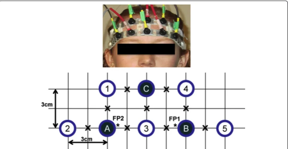 Figure 1 Source-detector configuration. Source-detector configuration. Each open circle represents a source-pair comprising one 690 nm andone 830 nm source fibre, while each solid circle represents a detector