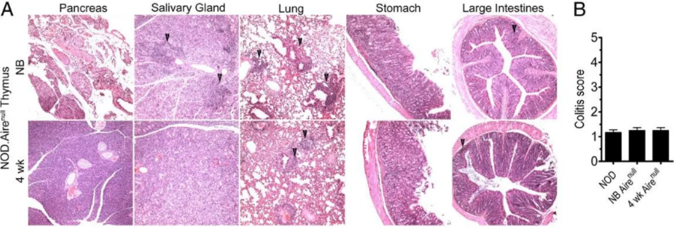 Figure 5. Temporal development of autoreactive T cells is independent of AIRE in some organs