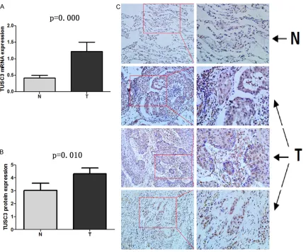 Figure 1. Increased expression of TUSC3 in the tumor samples of 40 NSCLC patients compared to their adjacent normal tissue