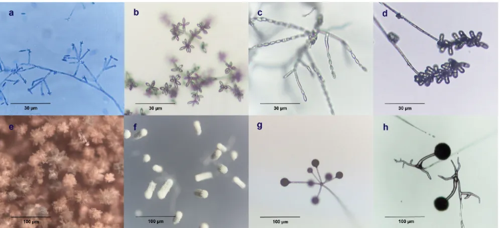 FIG. 2. Direct examination of an agar plate under a microscope before agar block cutting