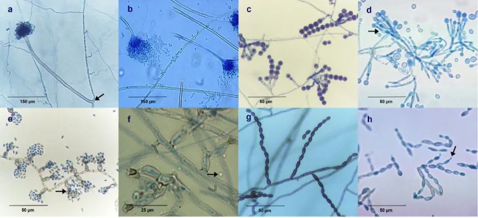 FIG. 3. Preservation of native structural features of fungi by agar block smears. (a) Aspergillus versicolorelliptical conidia arranged in chains from indistinct conidiophores