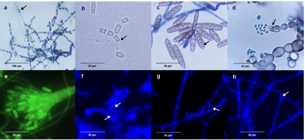 FIG. 4. Observation of fungal structures embedded under the agar surface in agar block smears