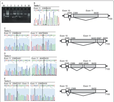 Figure 2 Identification of splicing variants within exon 11 in normal testesfrom Testis-1, -3, -4, and -5, respectively