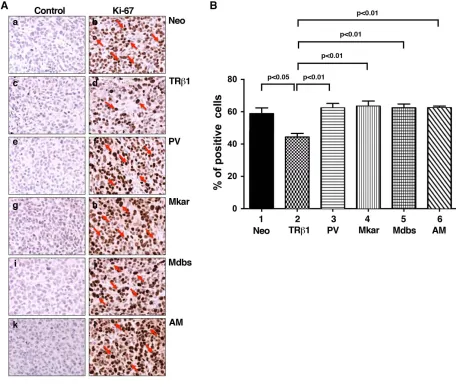 Figure 5: Comparison of cell proliferation by immunohistochemical analysis using the Ki-67 marker in tumor cells derived from Neo control cells, MDA-TRβ1, MDA-PV, MDA-Mkar, MDA-Mdbs, or MDA-AM cells