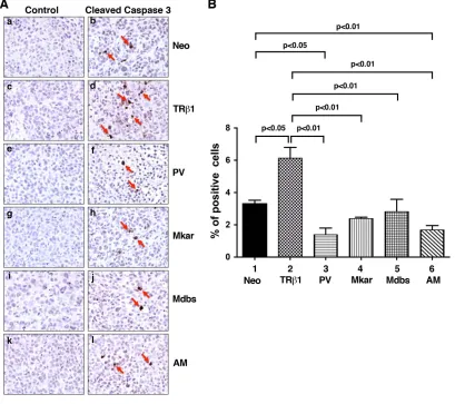 Figure 6: Comparison of apoptosis by immunohistochemical analysis using cleaved caspase 3 as a marker in tumor cells derived from Neo control cells, MDA-TRβ1, MDA-PV, MDA-Mkar, MDA-Mdbs, or MDA-AM cells